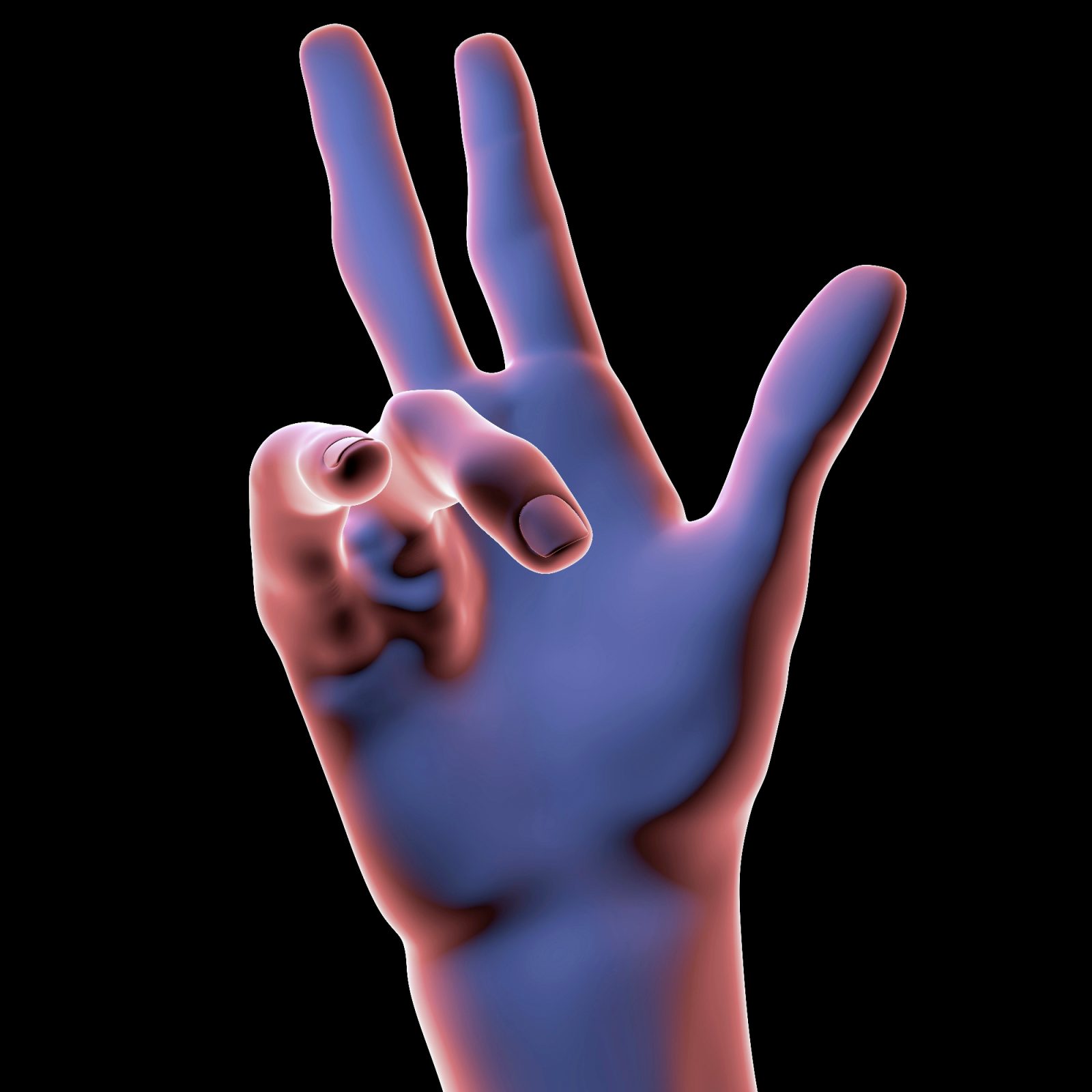 Dupuytrenova kontraktura mi je bila nekaj tujega